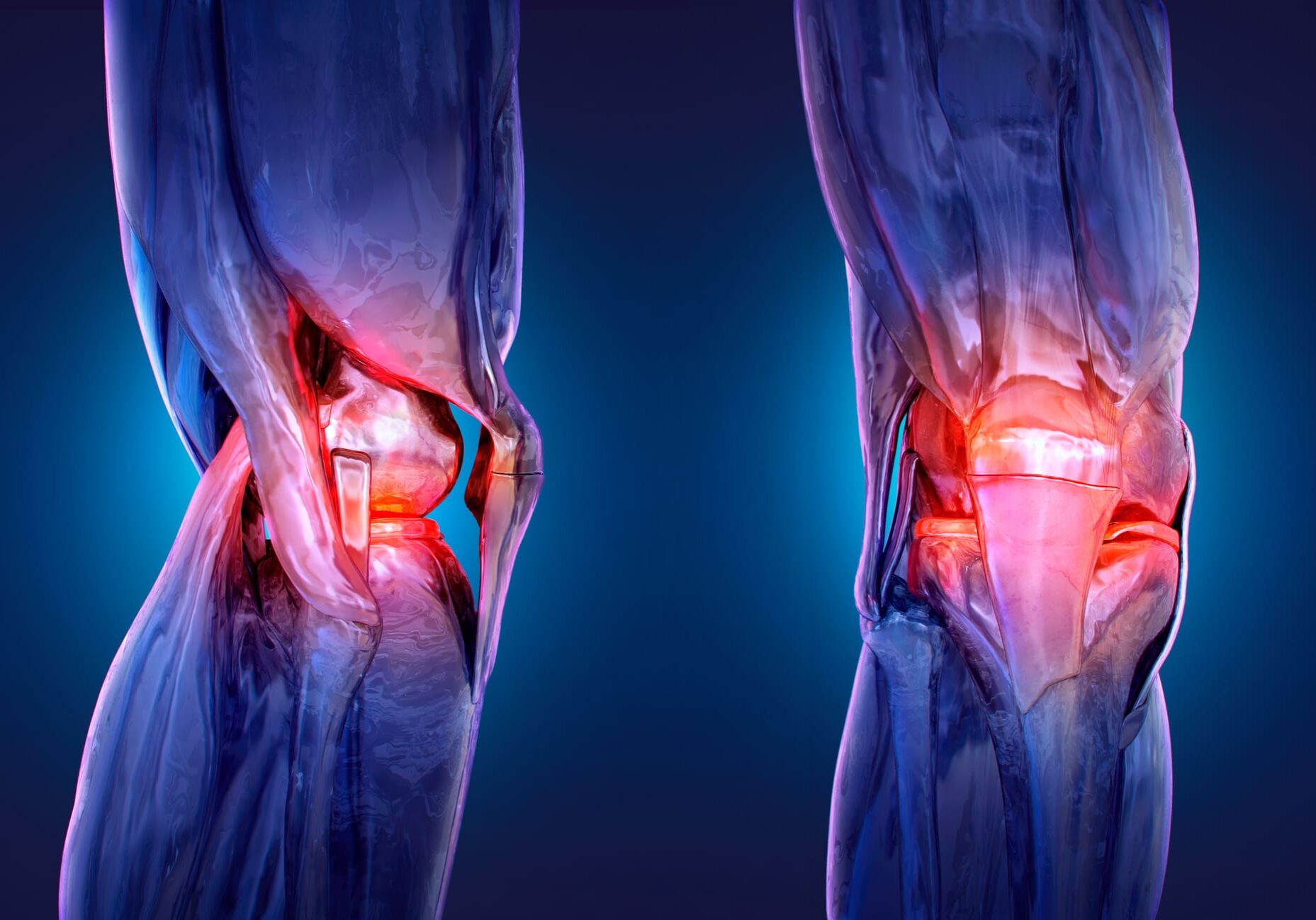 X-ray of human knees with highlighted joints.